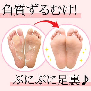 SOSU PERORIN FOOT PEELING PACK ROSE